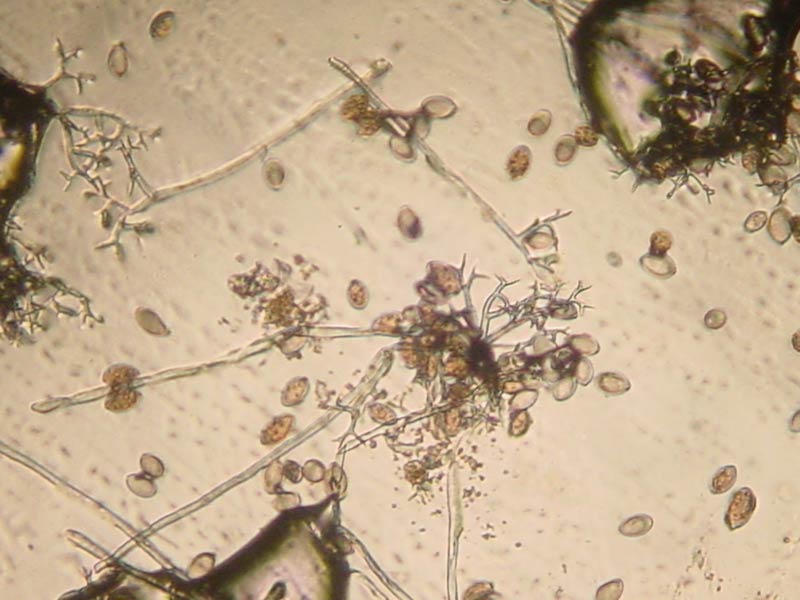 Microscopic photo of the sporangia