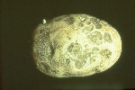 Photo of Early blight lesion on tuber