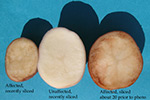 Photo of zebra chip symptoms on potato tuber