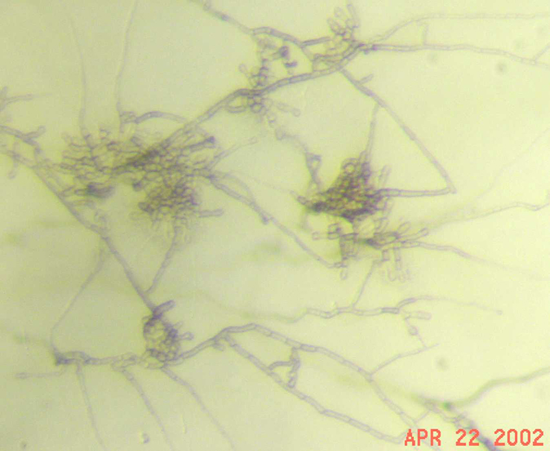 Holdfasts typically formed by <em>Phoma betae</em> when the fungus is grown on water agar and the hyphae come into contact with the plastic lower surface of the petri plate.