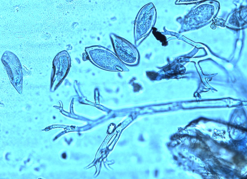 Microscope image of antler-shaped sporangiophores and lemon-shaped sporangia of the onion downy mildew pathogen, <em>Peronospora destructor</em>.