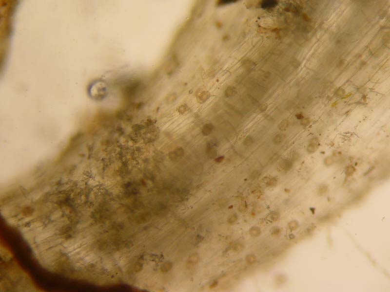 Photo of microscopic view of roots with round, thick-walled oospores of Pythium embedded in the root tissues.