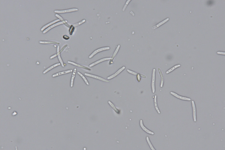 Photo of two-celled hyaline spores of Ramularia beticola