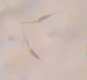 Photo of spores of alternaria dauci