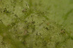 Photo of downy mildew sporangia on leaf surface