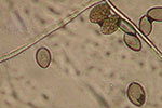 Microscopic photo of downy mildew sporangia